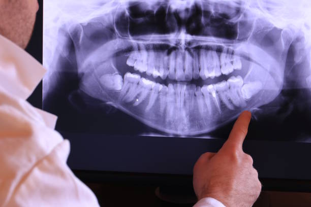 Best Holiday Emergency Dentist in Woodacre, CA