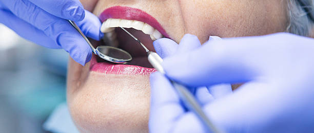 Best Broken or Cracked Tooth Emergency Dentist in Woodacre, CA